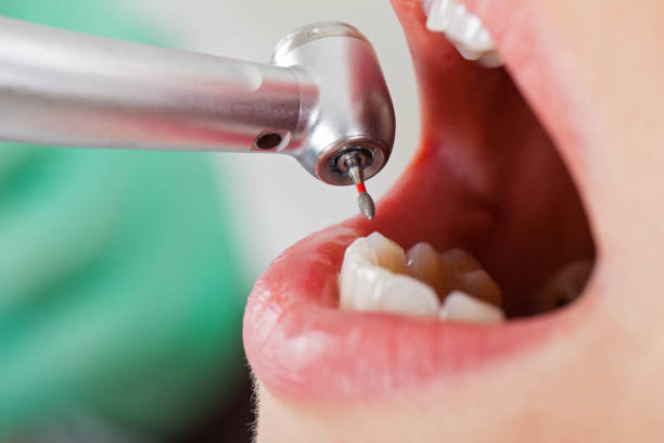 Best Pediatric Emergency Dentist in Syracuse, UT